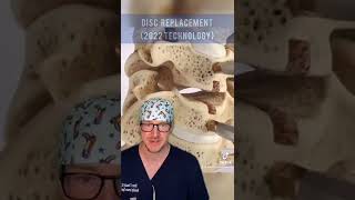 Disc Replacement Technology in 2022 (Texan Spine Surgeon Explains)