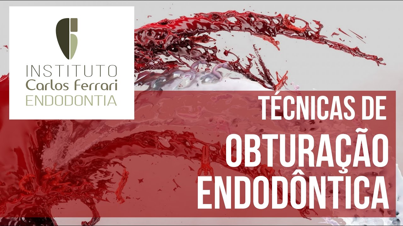 Obturação na endodontia - 2a parte. Técnicas