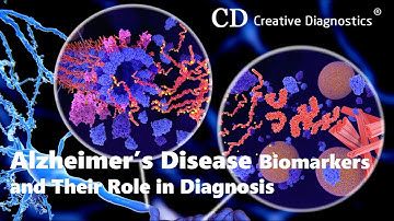 Alzheimer’s Disease Biomarkers and Their Role in Diagnosis