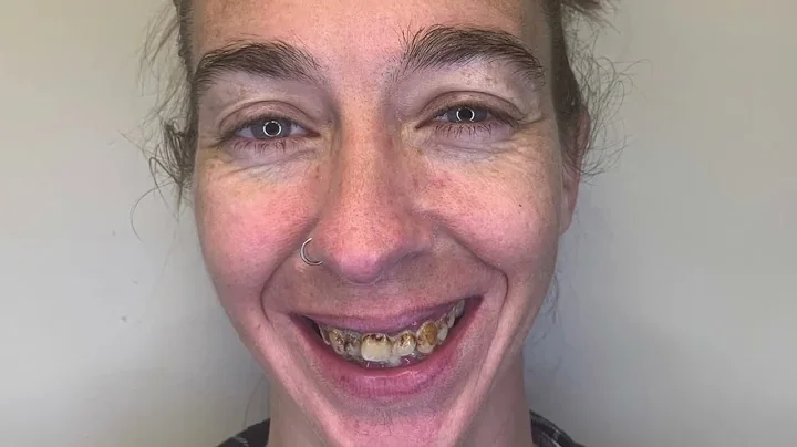 Jackie Seller shares AMAZING smile transformation story!