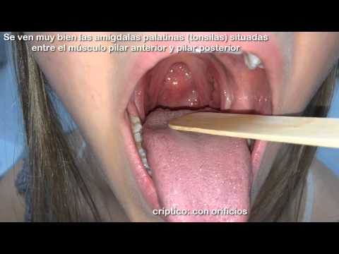 medicamentos para la inflamacion de la uvula medicamentos para la inflamacion de la uvula