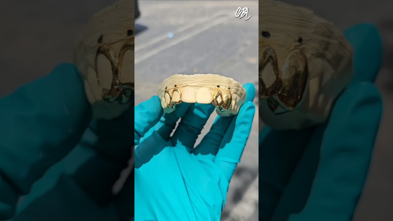 Custom Open Face Grillz 🤩 