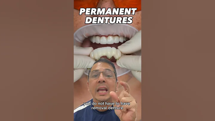 How to Get PERMANENT Full Denture | View Mobile Dental #shorts