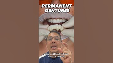 How to Get PERMANENT Full Denture | View Mobile Dental #shorts