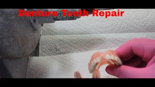 "Quick & Easy Denture Repairs: Save Your Smile in Minutes!"
