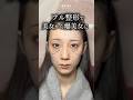 【美女から爆美女に⁉️💓術前から美しい患者様。1ヶ月後、更に洗練された印象に✨動画の最後に術前後で比較がございます！是非チェックしてみてくださいね🥹#astrabeautyclinic】