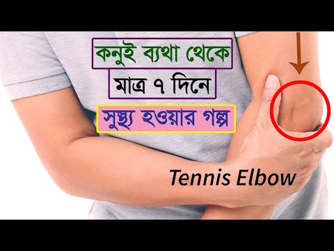 ভিডিও: টেনিস কনুই সুস্থ করার 4 টি উপায়