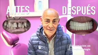 TESTIMONIO DR ISMAEL SORIANO GRAN PROFESIONAL - CENTRO CEOS - FORMACION EN IMPLANTOLOGÍA - DENTISTA