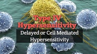 Type 4 hypersensitivity reaction Hindi  delayed hypersensitivity l Cell mediated hypersensitivity