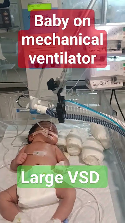 #newborn #Neonatal ventilator #large VSD..NB:12 # NICU