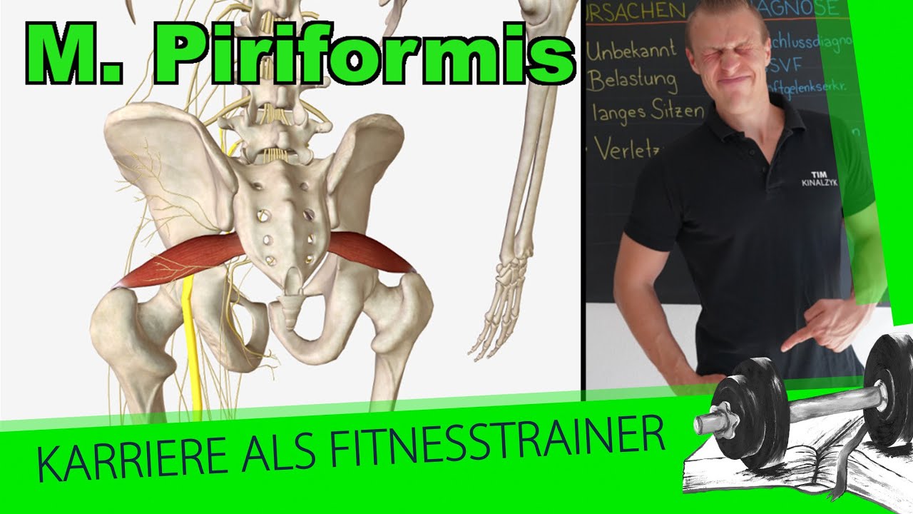 M. Piriformis Ansatz Ursprung Funktion | Piriformis-Syndrom Infos für Fitnesstrainer - YouTube