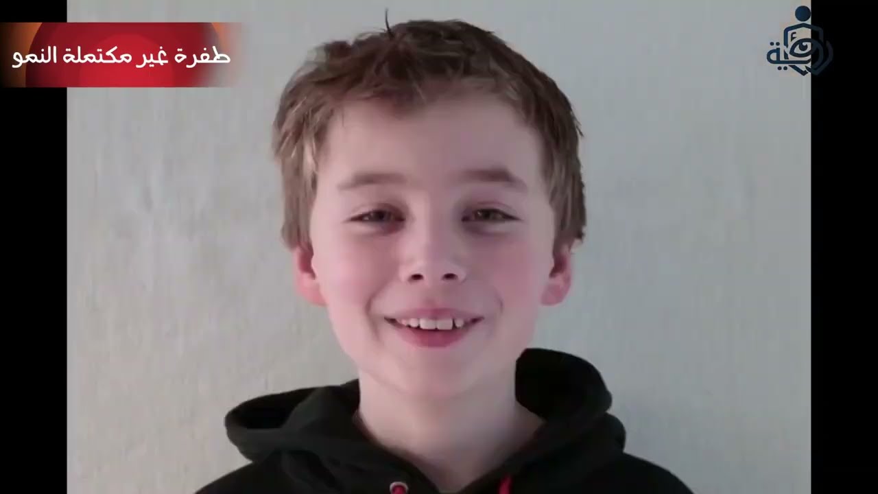 الطفرة غير مكتملة النمو