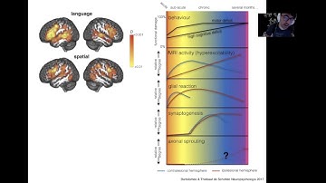 8 Brain Plasticity