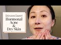 A Dermatologist’s Nighttime Skincare Routine for Hormonal Acne &amp; Dry Skin | Skincare Expert