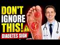 👉 Your Feet Are Warning You! 9 Early Signs of Diabetes | Dr. Michael Kent