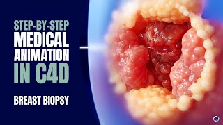 Step-by-Step Medical Motion Design | Breast Biopsy Animation in Cinema 4D