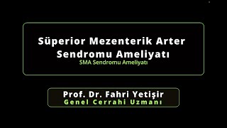 Süperior Mezenterik Arter  Sendromu Ameliyatı