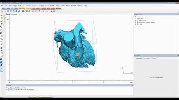 Tutorial: Mimics Innovation Suite - Create a Heart Model for 3D Printing