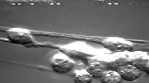 Neural Tube Development Cell Nuclei Migration