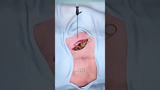 How Embalming A Body Works