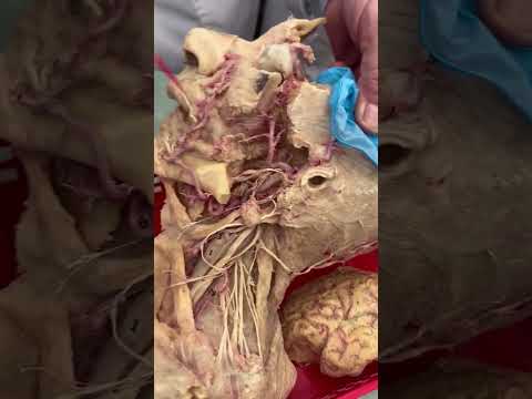 #trigeminalnerve #anatomy