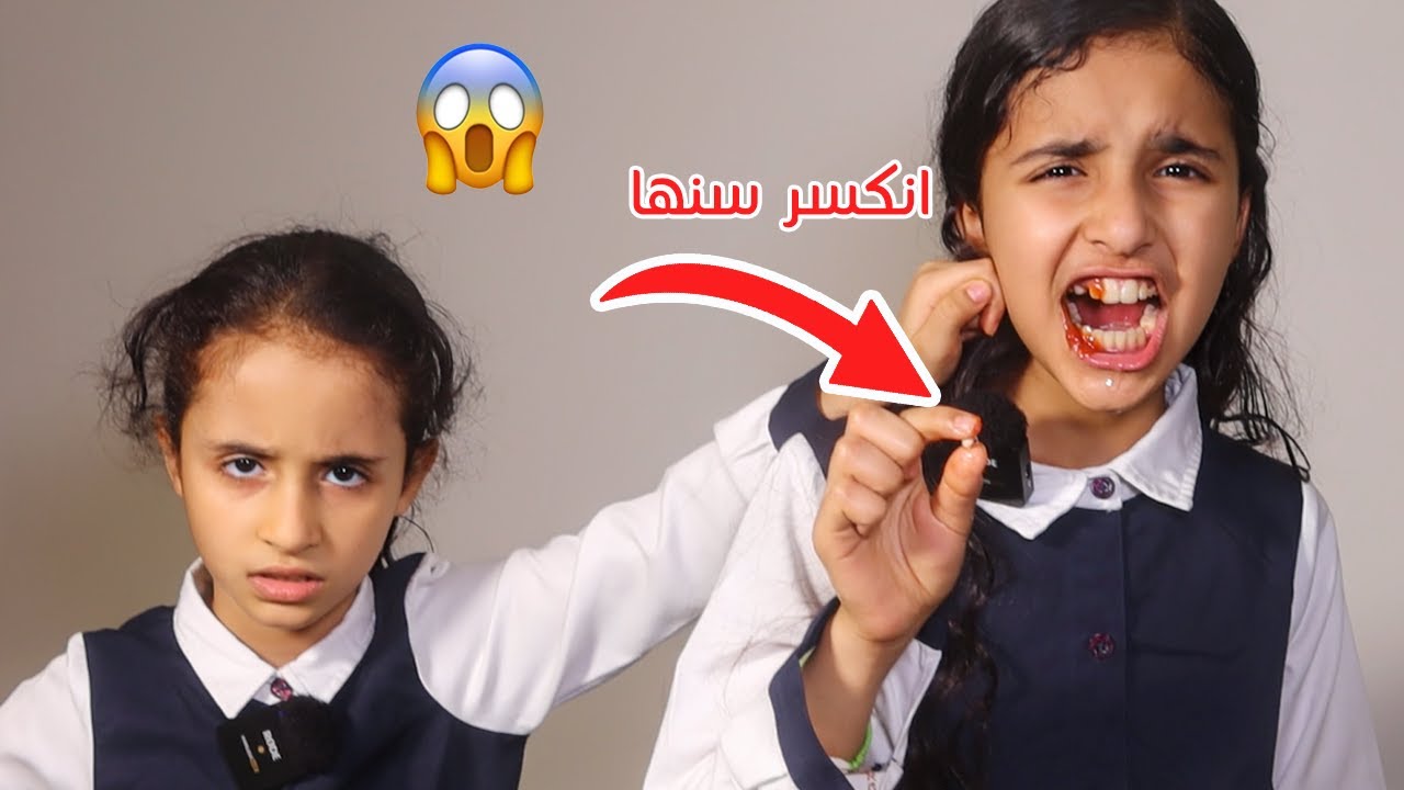 Когда у вашей дочери сломался зуб из-за издевательств в школе | Душераздирающе!! (Истории девочек)