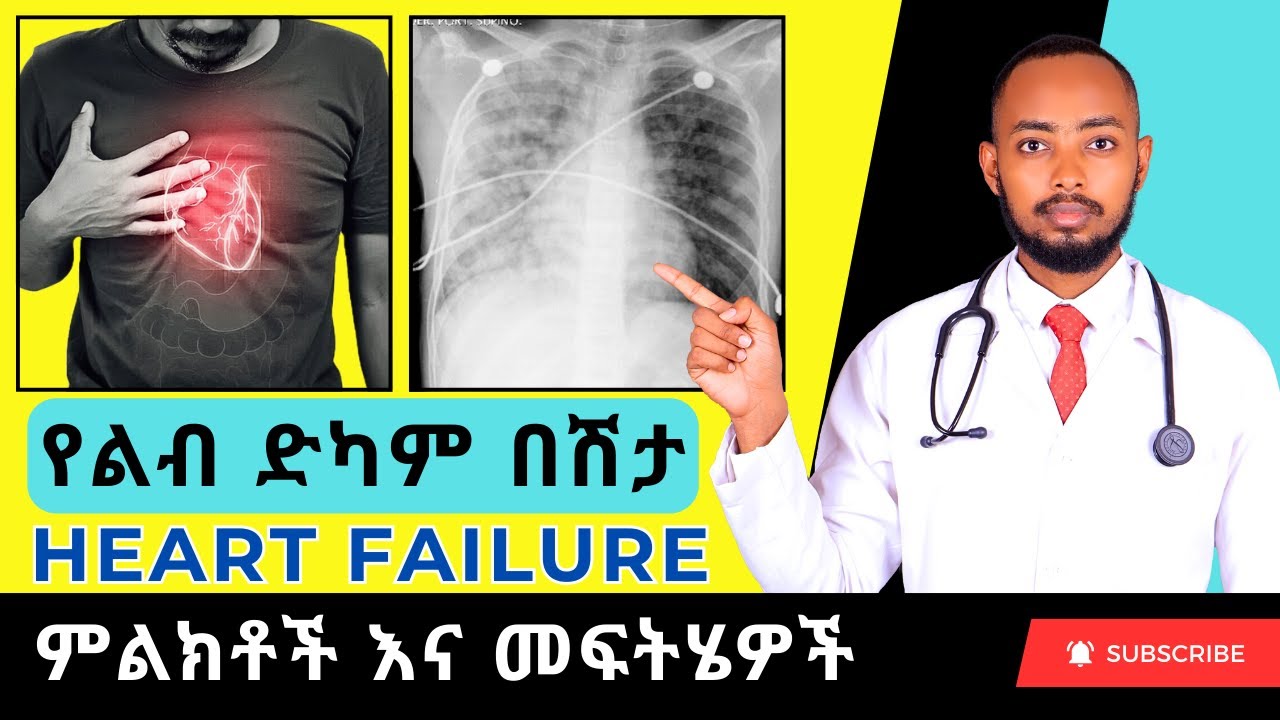 Ethiopia | የልብ ድካም በሽታ ምክንያቶች፣ ምልክቶች እና መፍትሄዎች