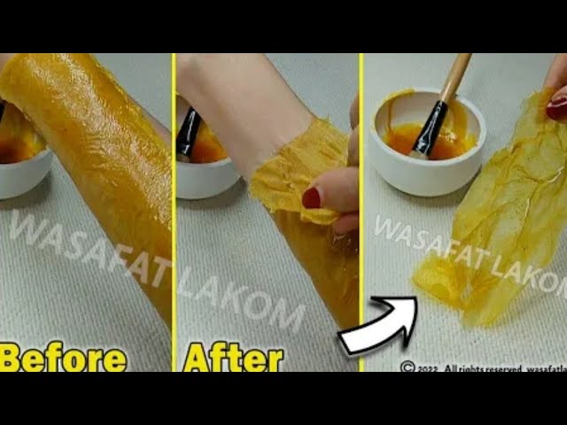 100%Натуральное домашнее средство.#удаление волос