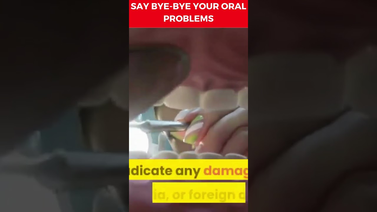 How To Get Rid Of My Oral Health Problems?| #shorts #yellowteeth #oralhealth