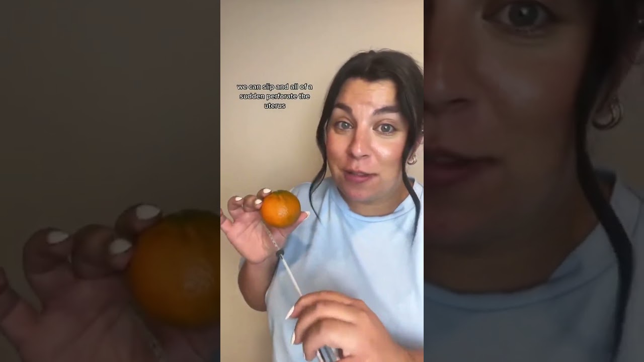 Surprisingly, the cervix is very mobile