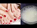 पैरो में सालों साल जमी मैल गंदगी बदबू मिनटों में साफ कर गोरा बनाए | FEET WHITENING BLEACH AT HOME