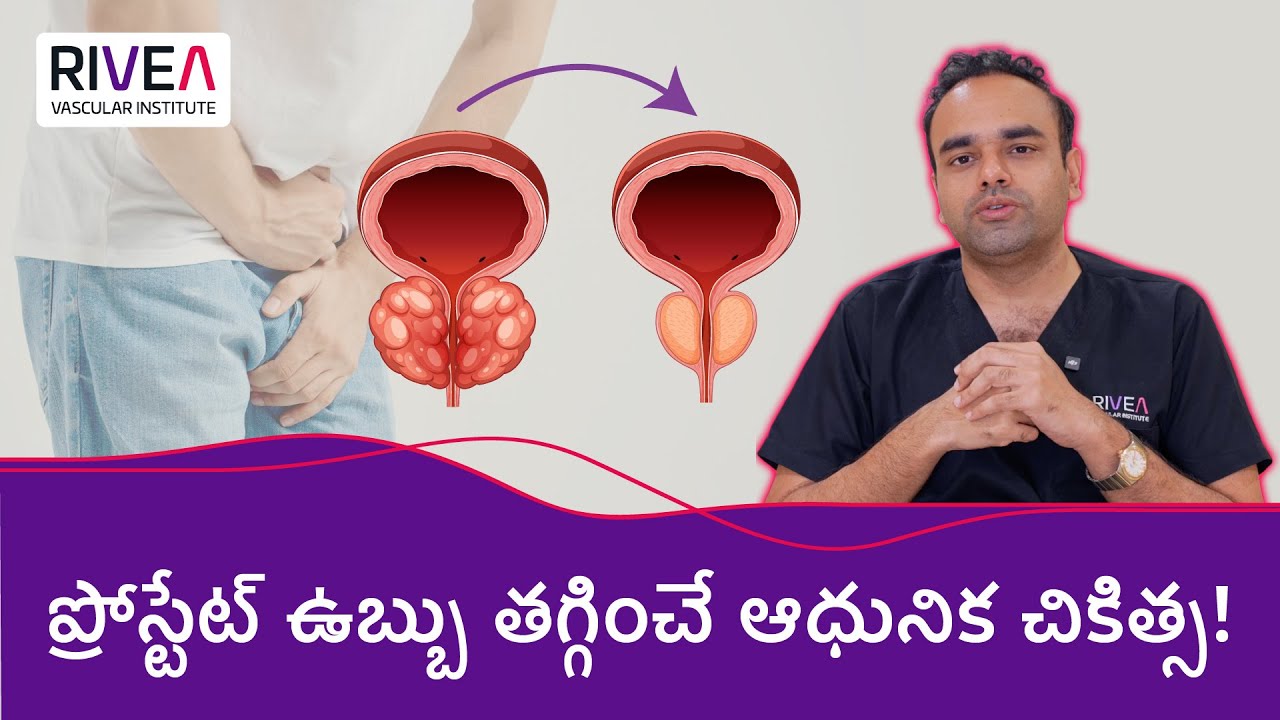 Prostate Enlargement Relief Without Surgery: PAE Explained | RIVEA