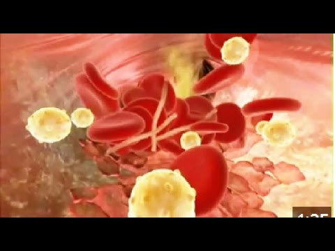 Vídeo: Fenotipo De Células Inmunes En Bajos Volúmenes De Sangre Para La Evaluación Del Riesgo De Enfermedad Cardiovascular, Desarrollo Y Progresión: Un Estudio Piloto