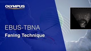 EBUS-TBNA: Faning Technique for Sample Acquisition | Pulmonology | OLYMPUS