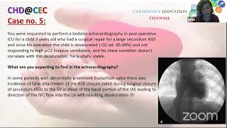 CHD@CEC, Webinar 2, ASD screenshot 4