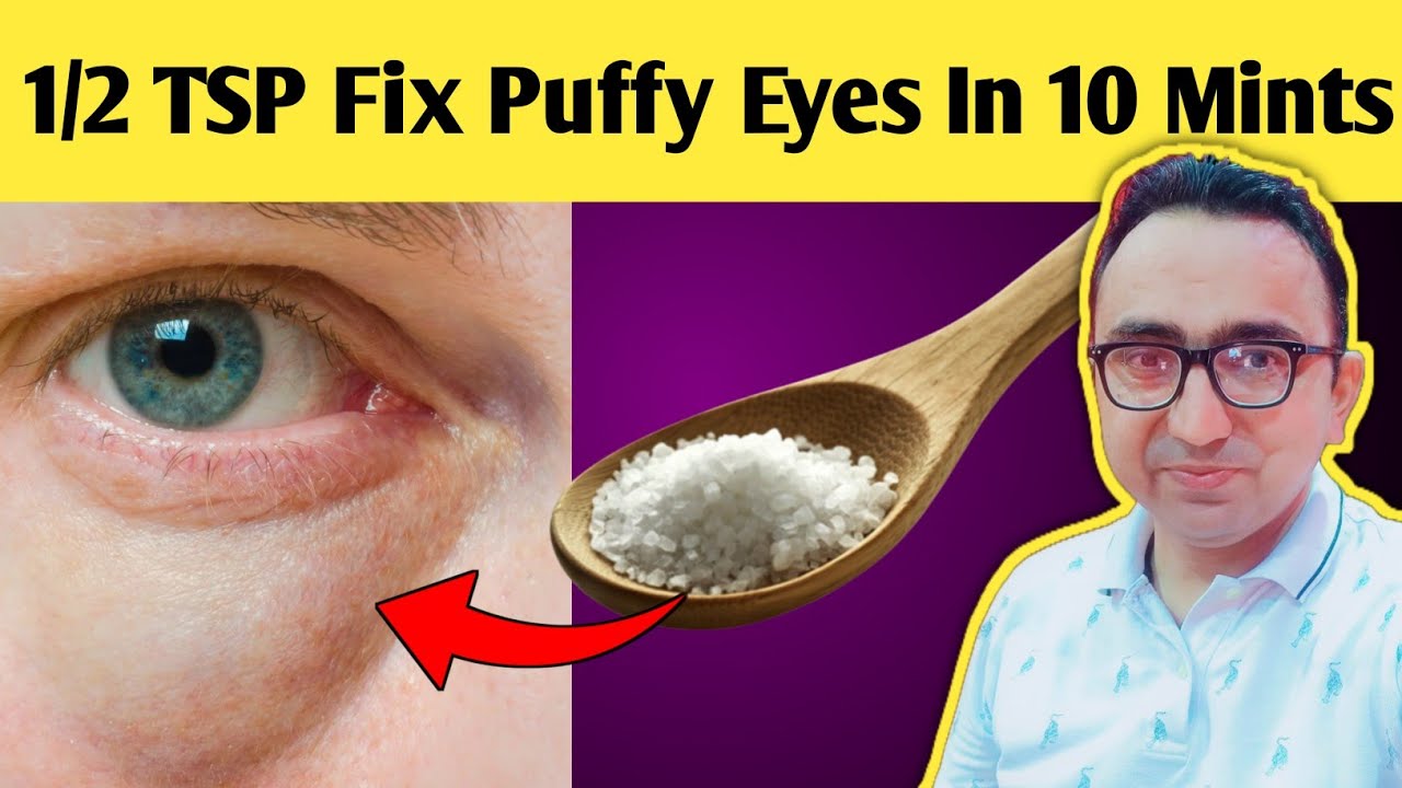 Puffy Eyes FIXED with 1 Simple Kitchen Ingredient