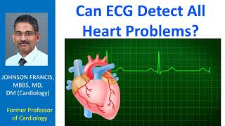 Can ECG detect all heart problems?