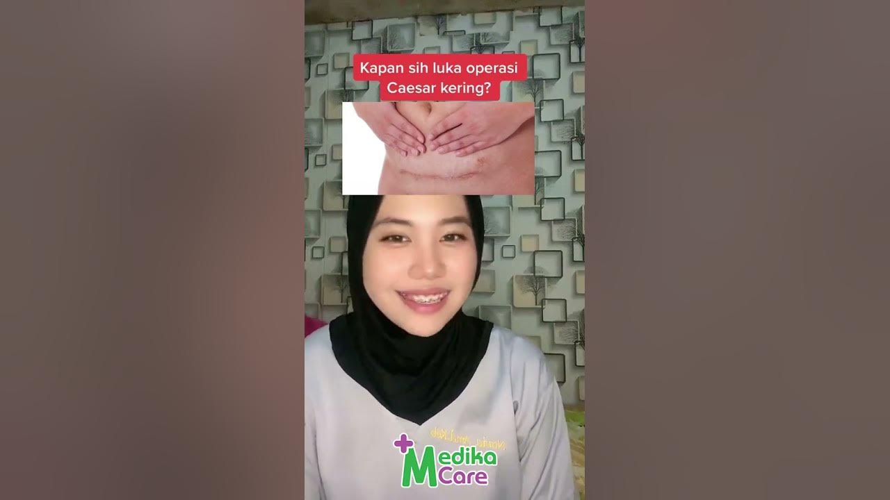 Luka Operasi Caesar Lama Keringnya?