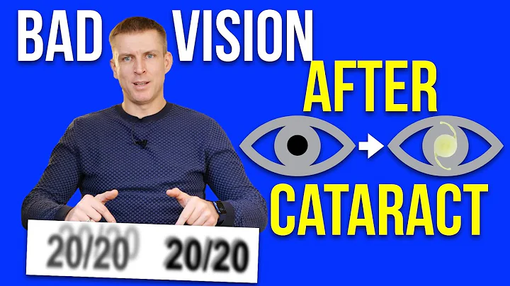 Bad vision after cataract surgery
