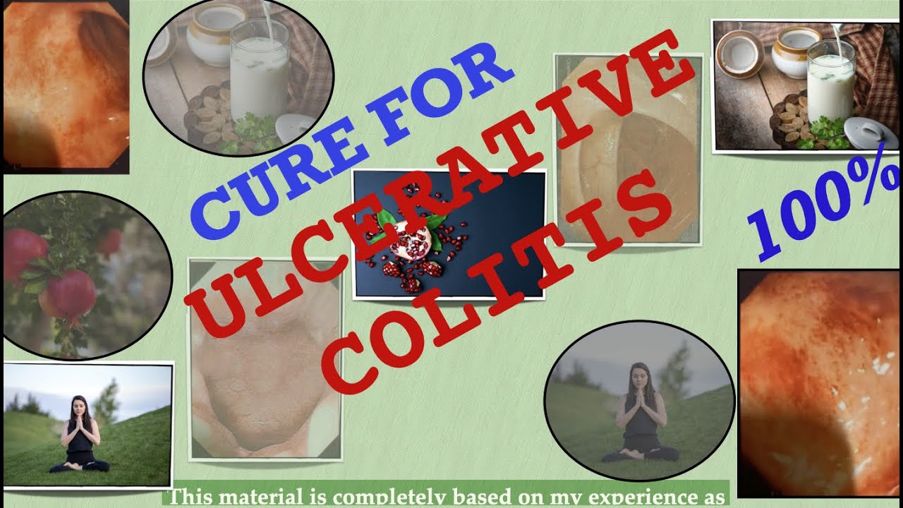 AR GoodVibes "Miraculous tips to cure UC (Ulcerative Colitis)"