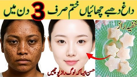 Pigmentation Treatment on Skin at Home 😍 | Get Glowing Skin FAST| 100% Natural Skin Whitening Remedy