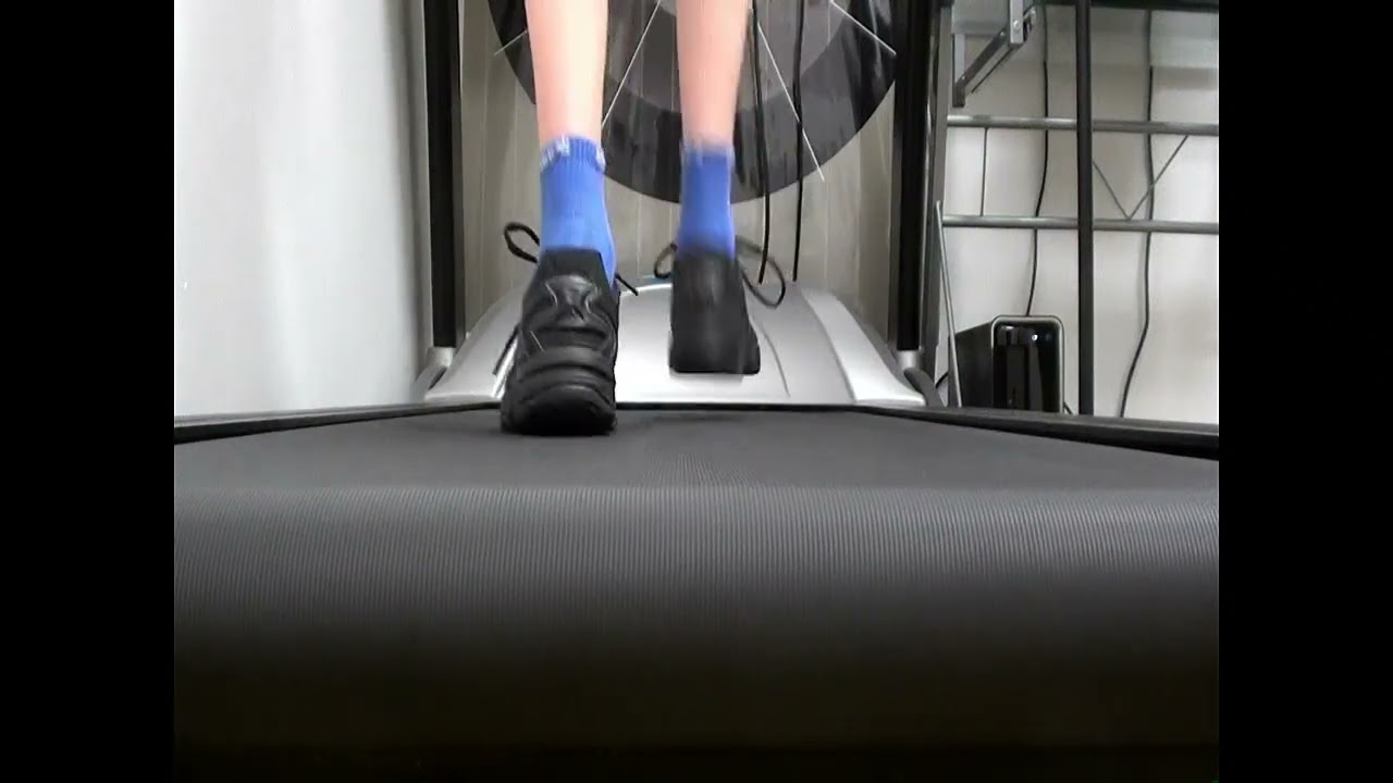 Does your child have flat feet?