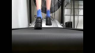 Does Your Child Have Flat Feet?