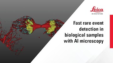 Fast rare event detection in biological samples with AI microscopy