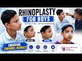 Boy’s Nose Surgery Transformation | Rhinoplasty Journey