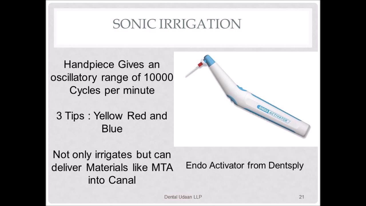 Sonic Irrigation in Canals of Tooth