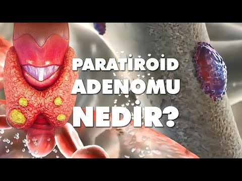Video: Paratiroid nə edir?