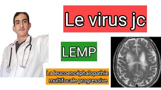 Le Virus Jc Et La Leucoencéphalopathie Multifocale Progressive Lemp
