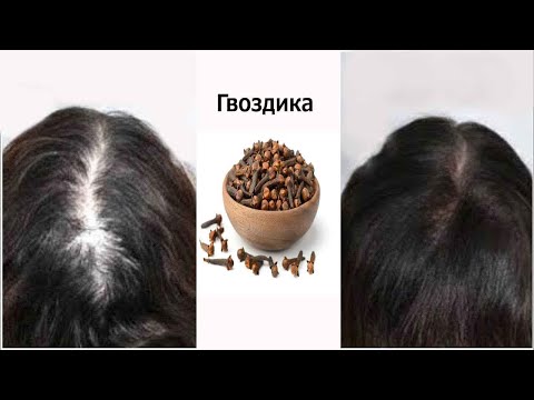 Смешайте гвоздику с миндальным маслом  🌿 индийский секрет быстрого роста волос и лечения облысения