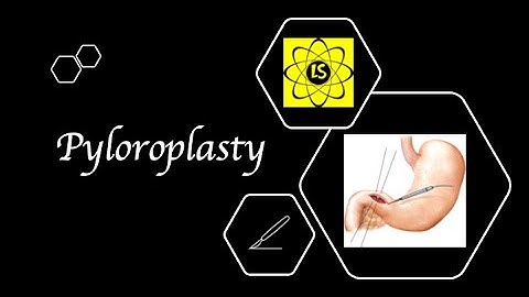Pyloroplasty